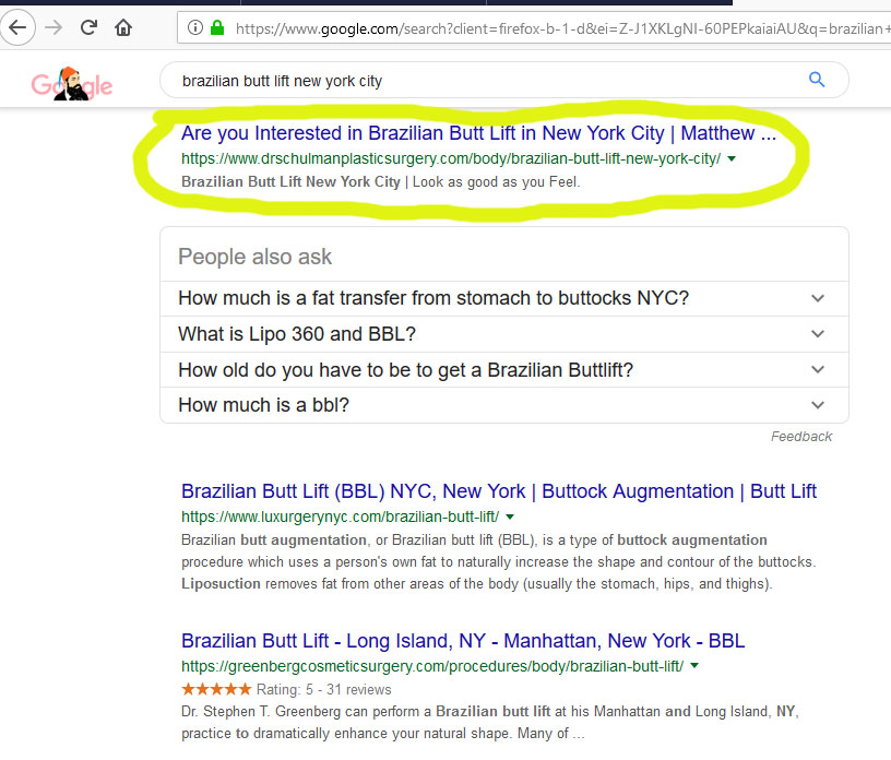 Brazilian Butt Lift New York City