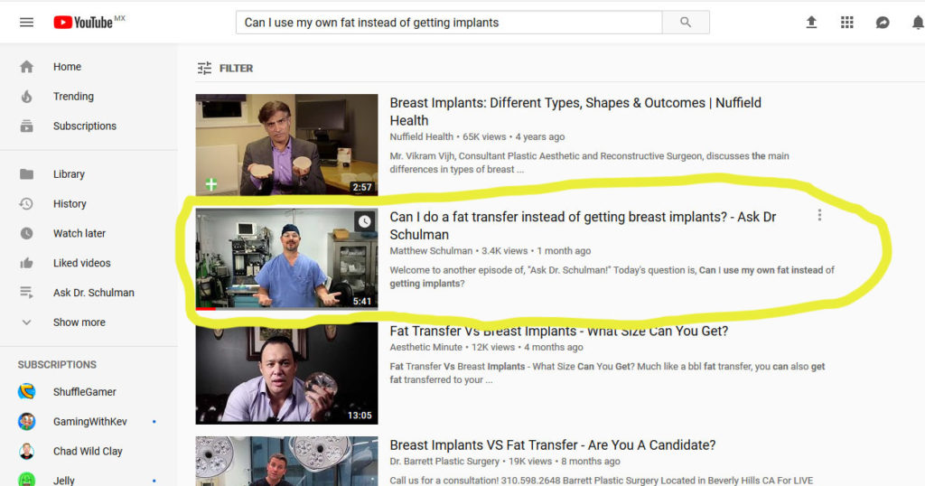 Can I use my own fat instead of getting implants
